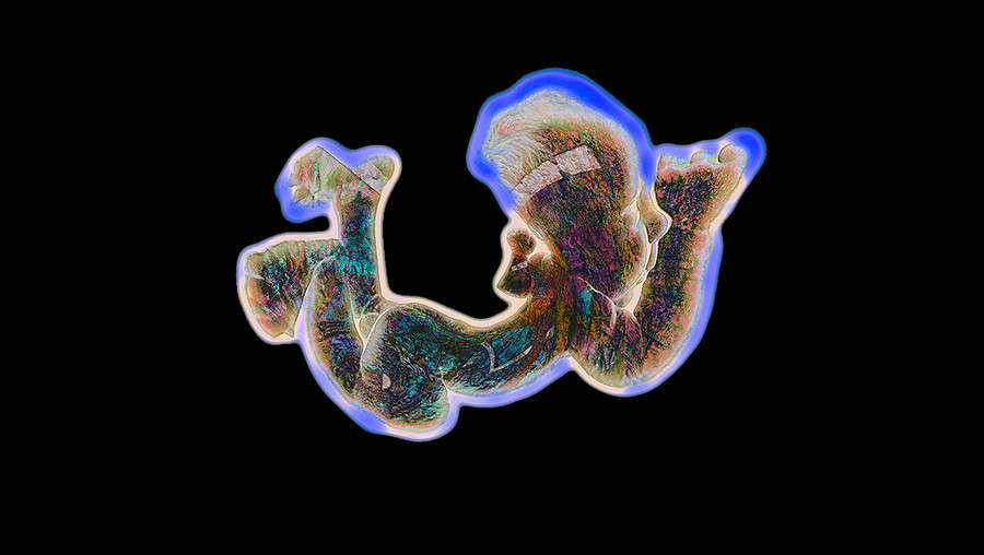 baby1-I-2.jpg : Being Human : American artist digital invention archival artifact color print image emerging capture creative convergent transparency universe dream history painter Hybrid exhibition